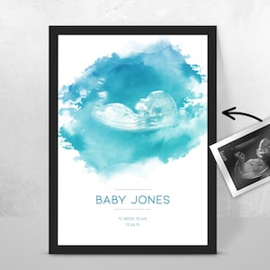 Personalised BABY Scan Ultrasound Watercolour Print 4D first baby scan/Baby Shower Gift/ New mum to be/ Bump gift/ Pregnancy Keepsake Mum