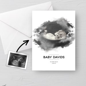 Personalisierte BABY Scan Ultraschall Aquarell Grußkarte 4D erster Baby scan/Baby Shower Geschenk/ Neue Mama zu sein/ Bump Geschenk/Herzlichen Glückwunsch