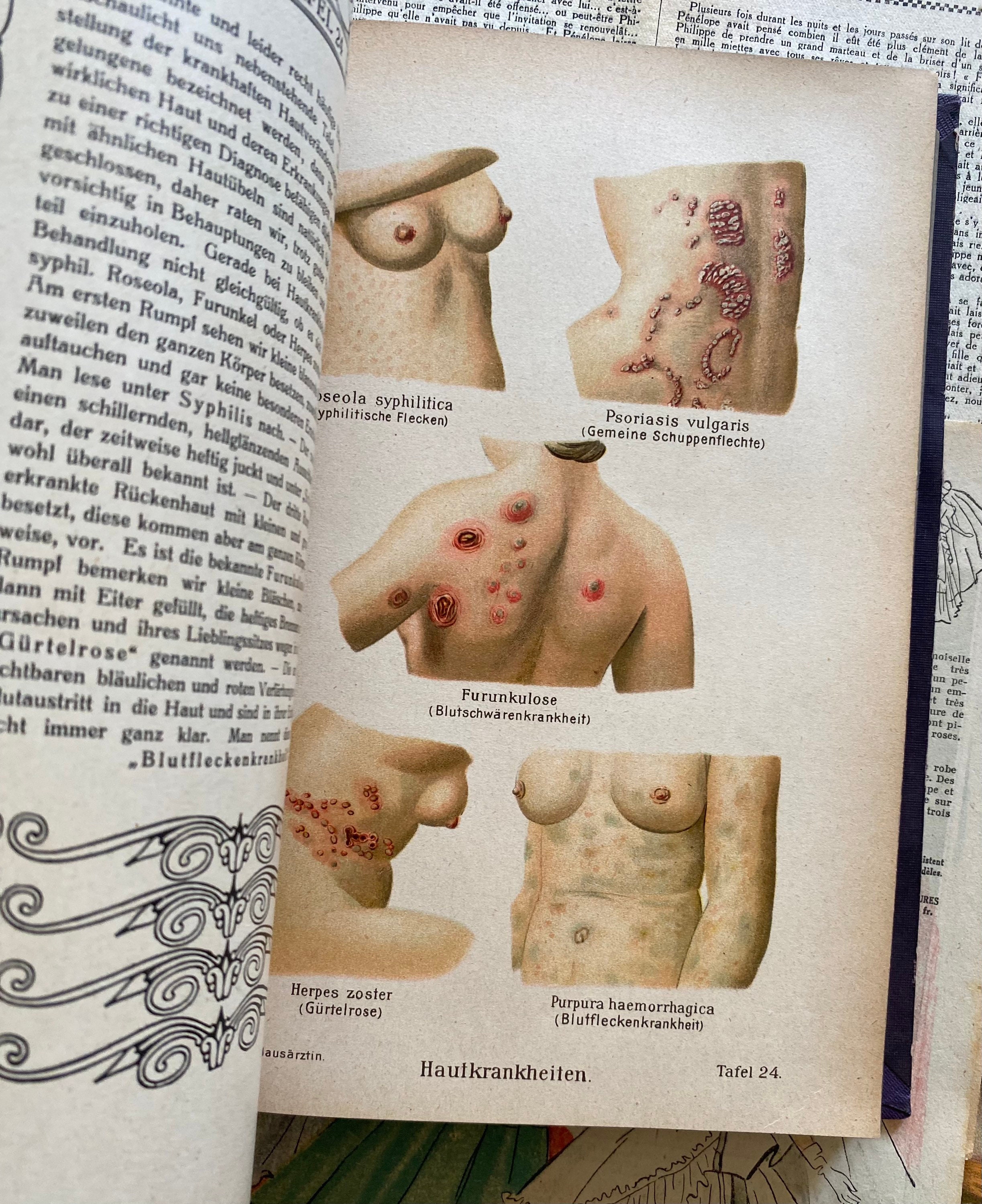 ヴィンテージのドイツの医学書、カラー図版とイラスト、絵本