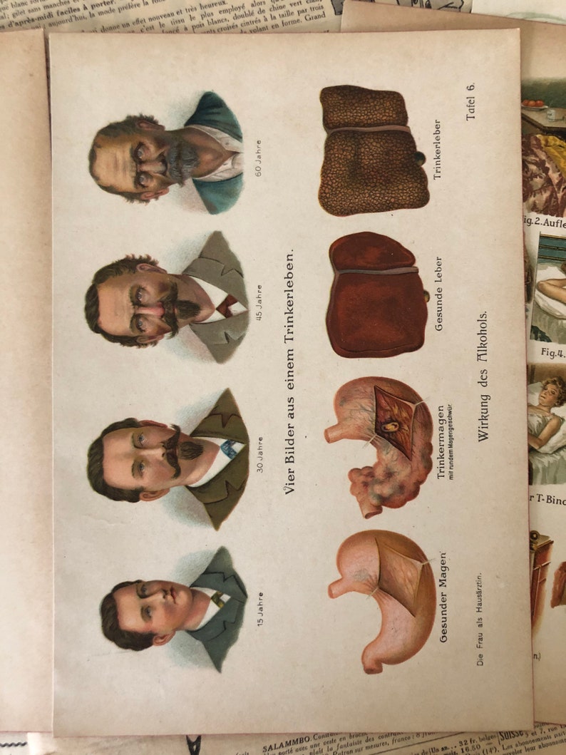 Vintage Medical Art Prints Set of 5 Medical Bookplates Human Etsy