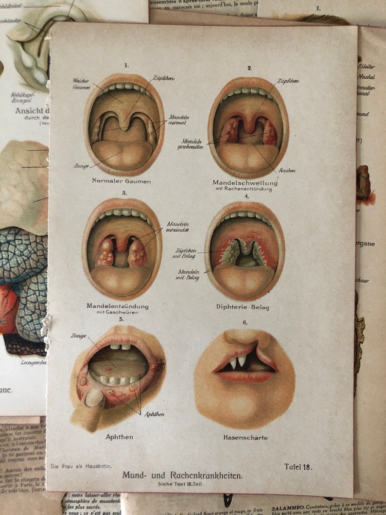 Vintage Medical Art Prints Set of 6 Medical Bookplates Human Etsy