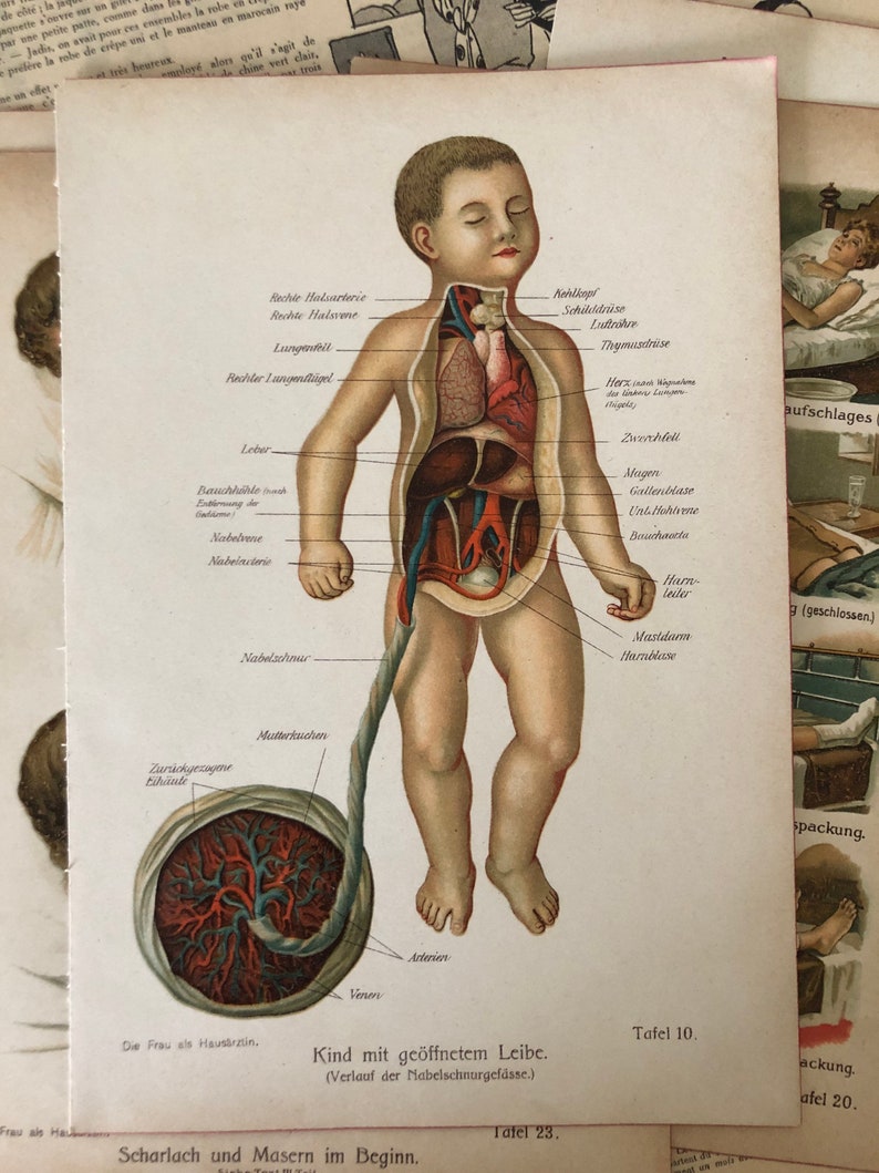 Vintage Medical Art Prints Set of 5 Medical Bookplates Human Etsy