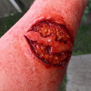 May include: A close-up of a simulated wound on an arm. The wound is a deep, open gash with exposed tissue and a dark red color. Surrounding skin is red and irritated, creating a realistic effect.
