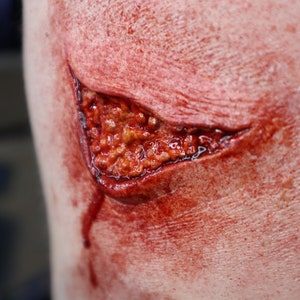 Pulled/ Torn Fatty Fleshy Wound Prosthetic