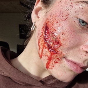 Gaping Infectious Fatty Wound Prosthetic