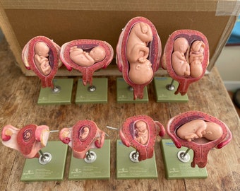 Full set of Vintage SOMSO EMBRYO DEVELOPMENT models 7 models Pregnancy MidWifery