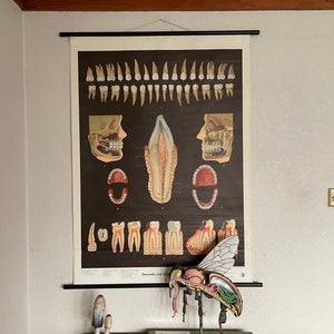 Vintage TEETH in HEALTH & DISEASE school wall chart educational medical dental tooth decay