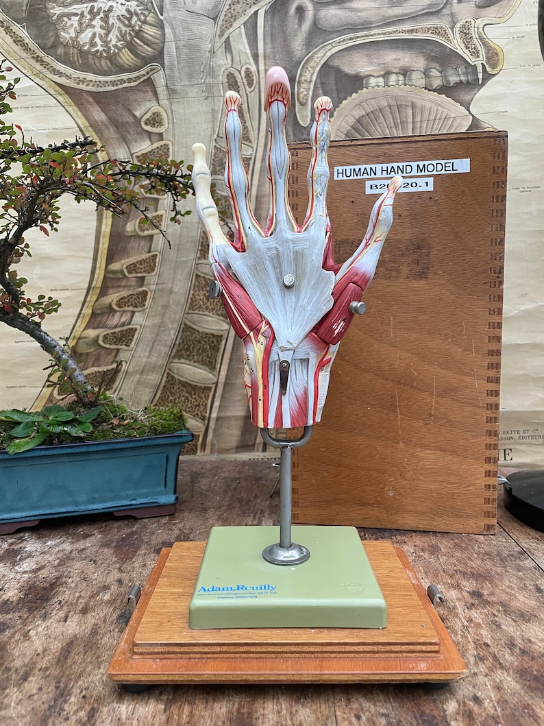 Vintage SOMSO Human Hand Anatomy Model: Educational Medical Display - Etsy
