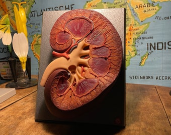 Vintage SOMSO HUMAN KIDNEY model educational model Anatomy model medical 1950-1979