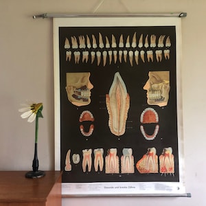 Vintage TEETH in HEALTH & DISEASE gráfico de pared de la escuela educativa dental médica dental caries dental