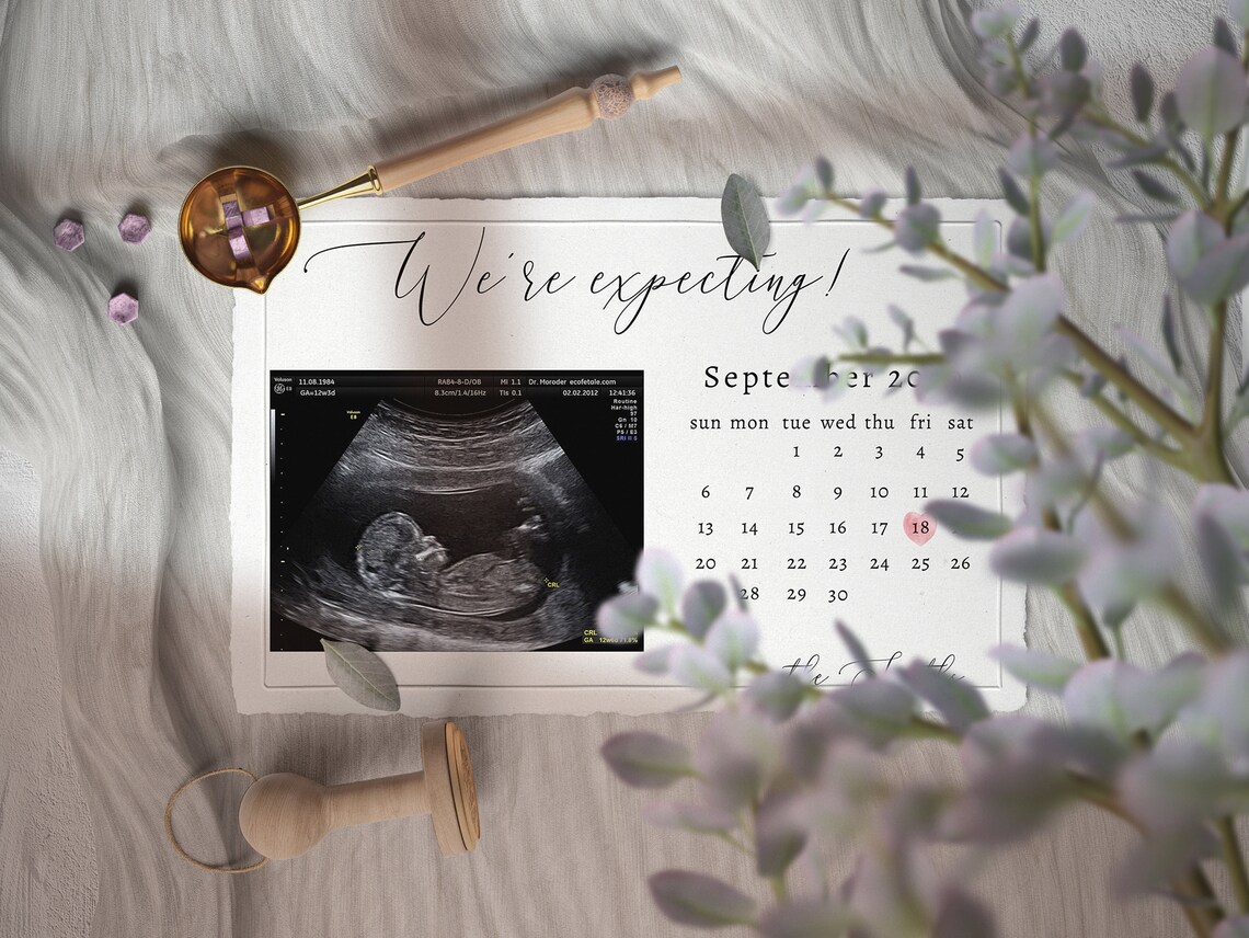 Elegant Pregnancy Announcement Template Due Date Calendar - Etsy