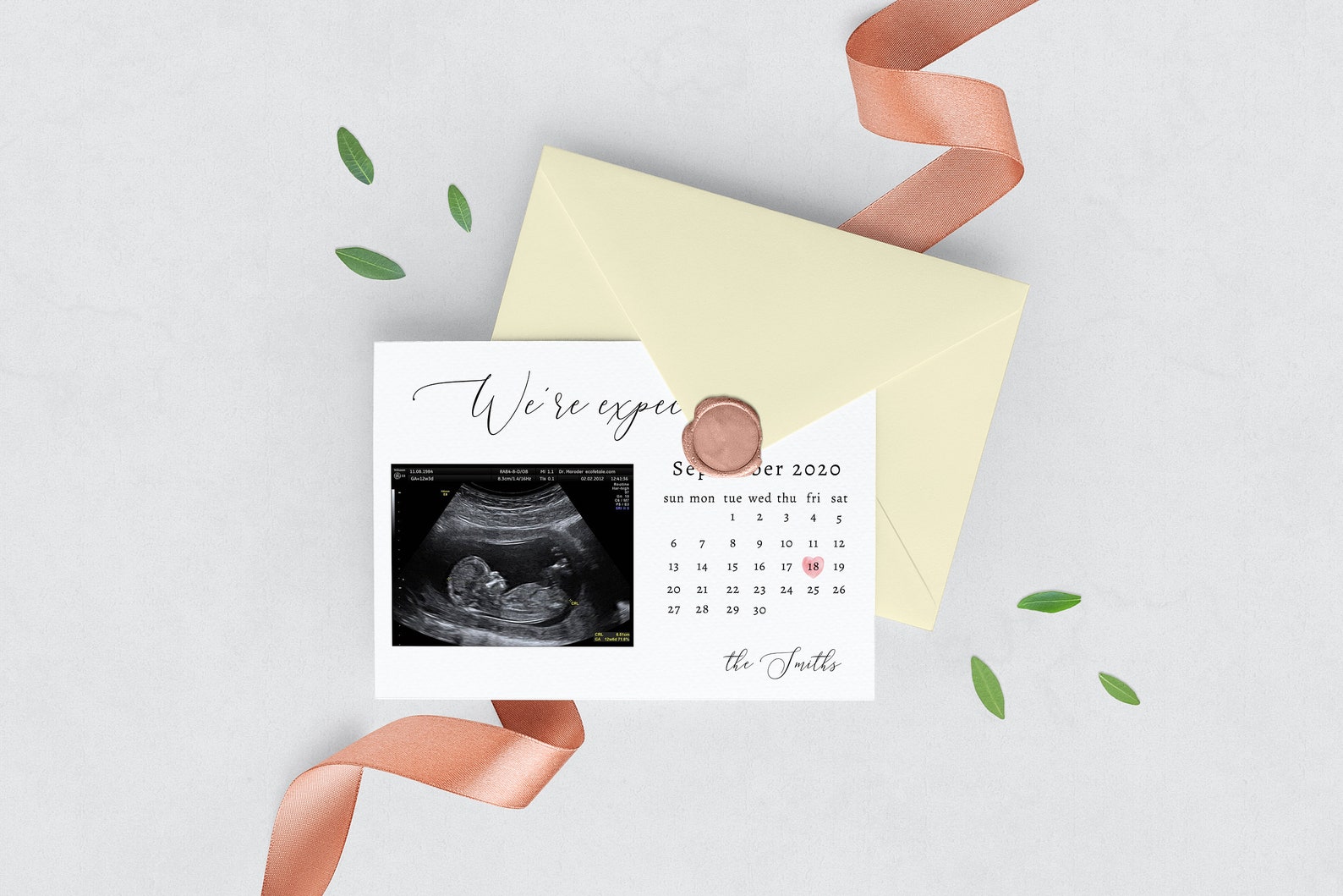Elegant Pregnancy Announcement Template Due Date Calendar - Etsy