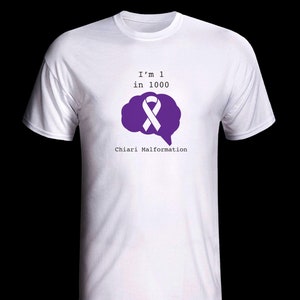 1 in 1000 Chiari