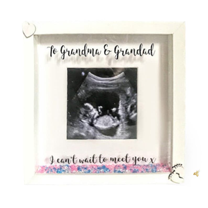 personalised baby scan