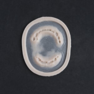 May include: A close-up of a white dental mold with a gray background. The mold shows the impression of a set of teeth.