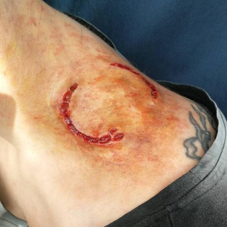 Shoulder with a bloody zombie bite prosthetic