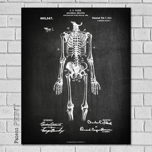 May include: A black and white vintage patent drawing of a human skeleton. The patent number 983,547 is visible at the top of the drawing. The patent was filed on February 7, 1911.