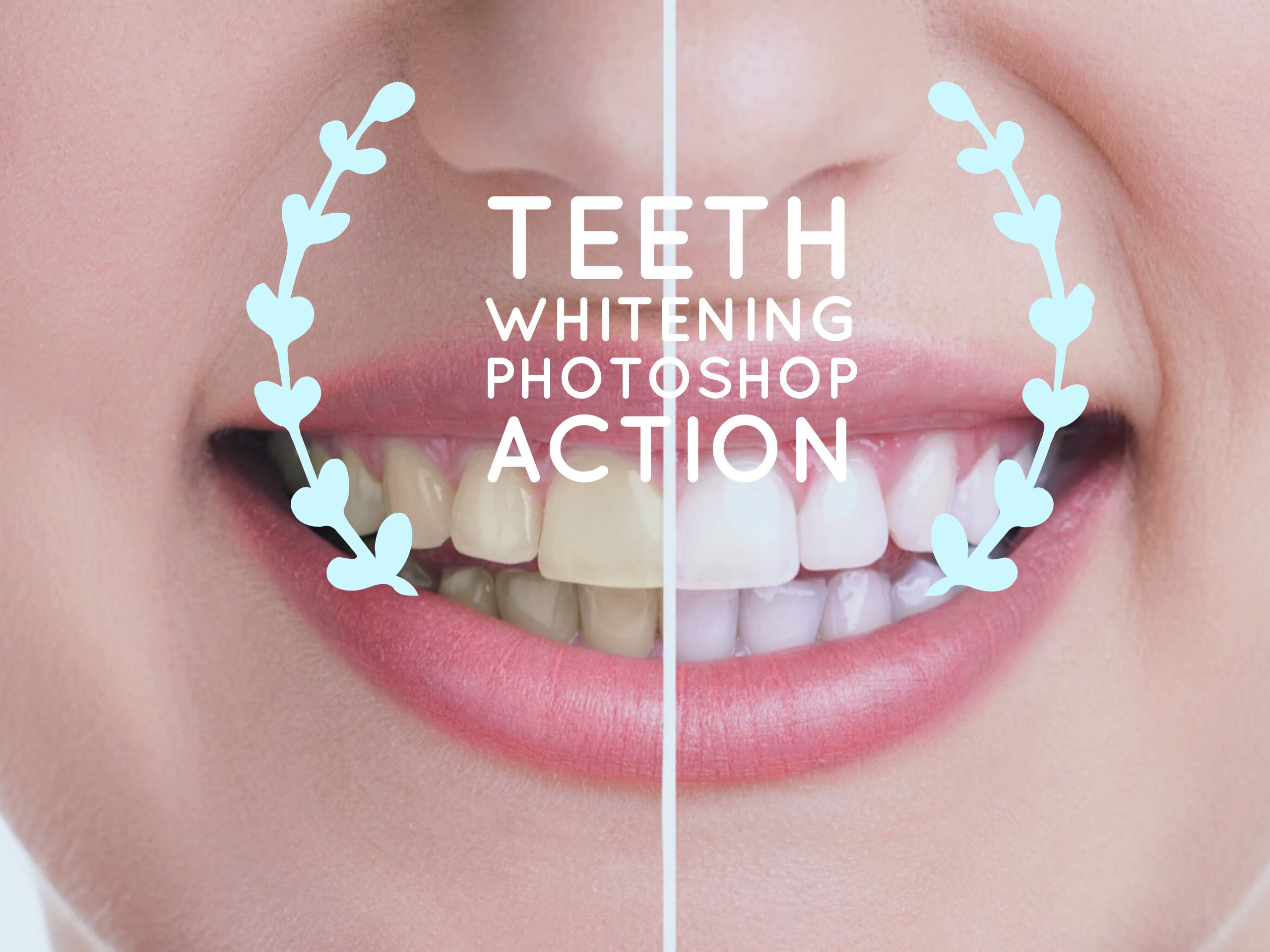 Teeth Whitening Action Etsy