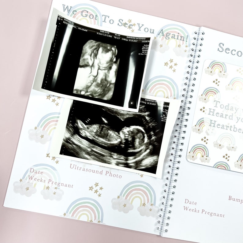 May include: A white pregnancy journal with a rainbow and star pattern. The journal has a spiral binding and includes a section for ultrasound photos. The text "We Got To See You Again!" is printed on the cover.