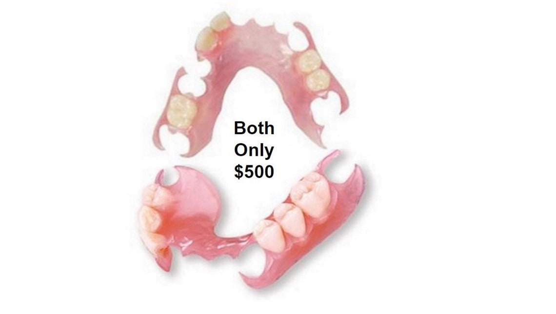 Both Upper and Lower Partial Dentures Online Flippers Etsy