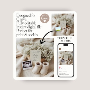 May include: A digital design for Canva, featuring baby booties, a sonogram, and a card with the text "Baby Ander". The design includes the text "A tiny miracle is growing... we are so excited."