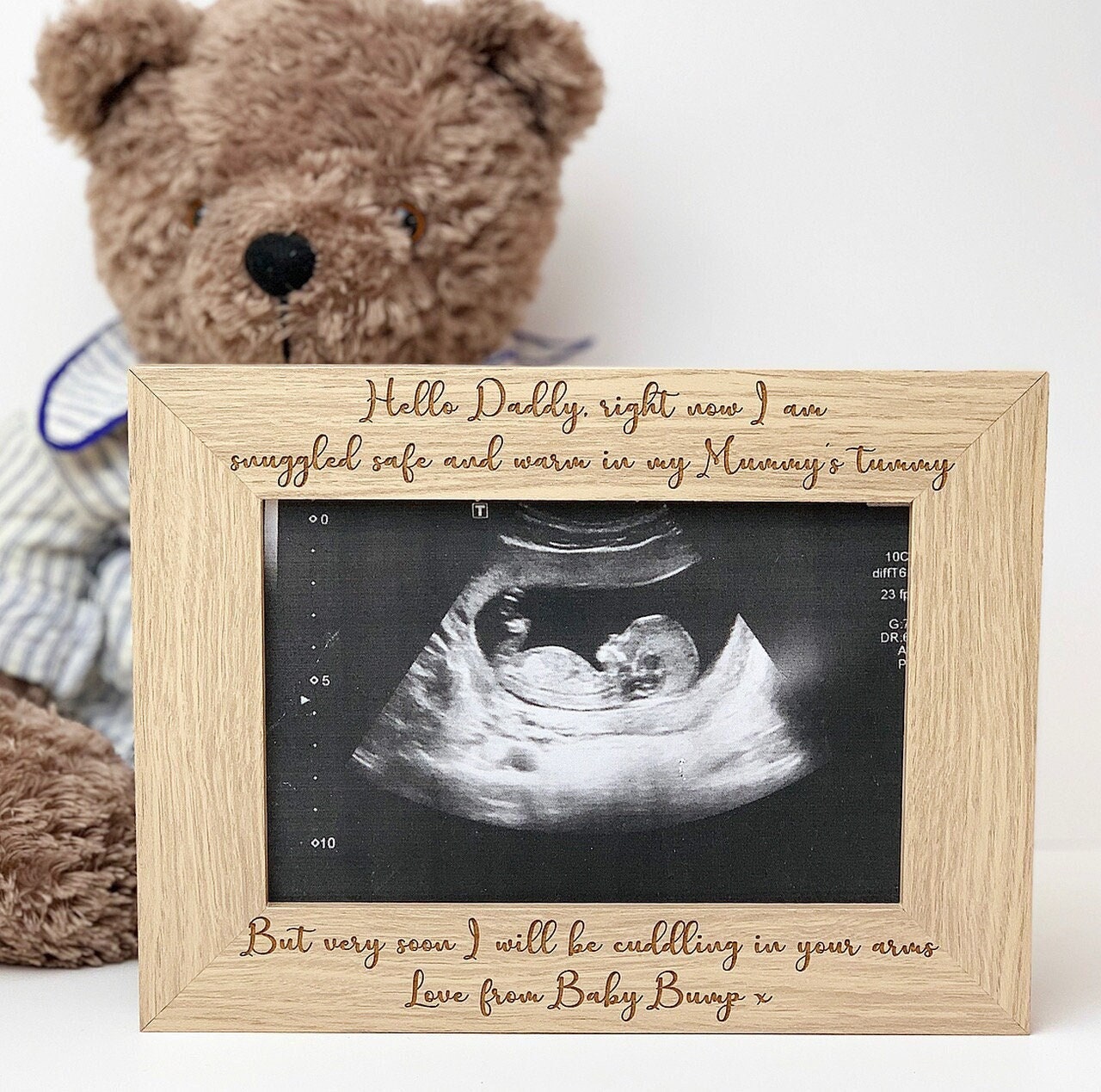 Échographie de bébé personnalisée Annonce de grossesse Cadre photo en bois  fabriqué à la main Photo Souvenir Cadeau Tout Libellé 6x4 -  France