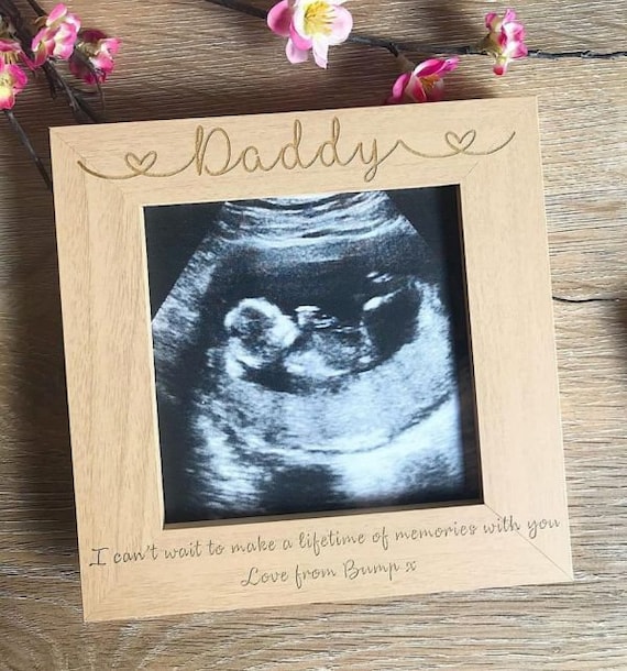 Making Memories Scan Frame Baby Scan Photo Frame Pregnancy Etsy