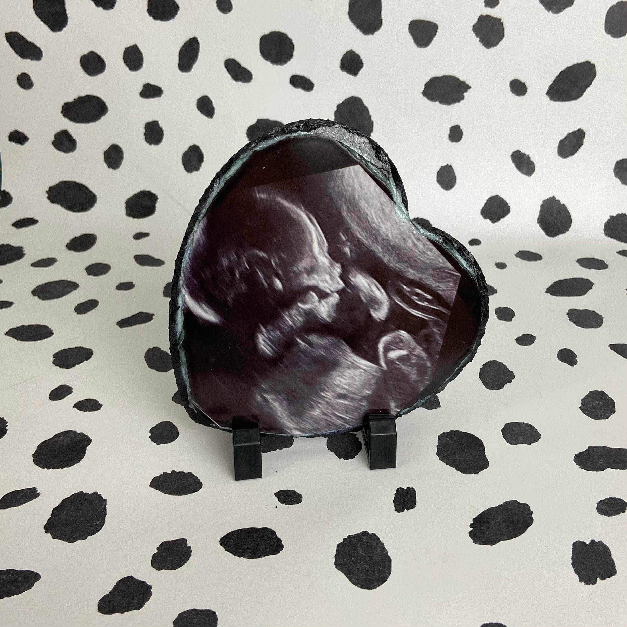 Baby Ultrasound Ultrasound Frame Miscarriage Keepsake New Etsy