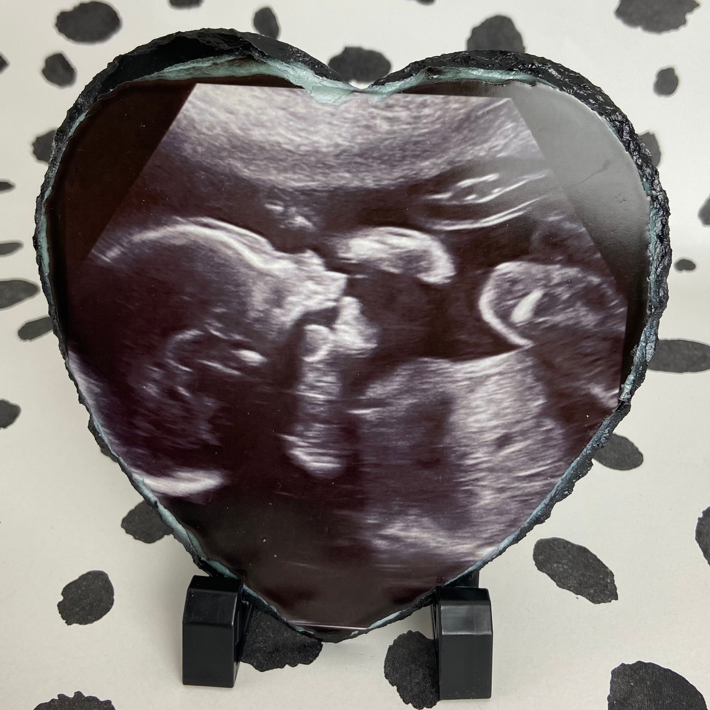 Baby Ultrasound Ultrasound Frame Miscarriage Keepsake New Etsy