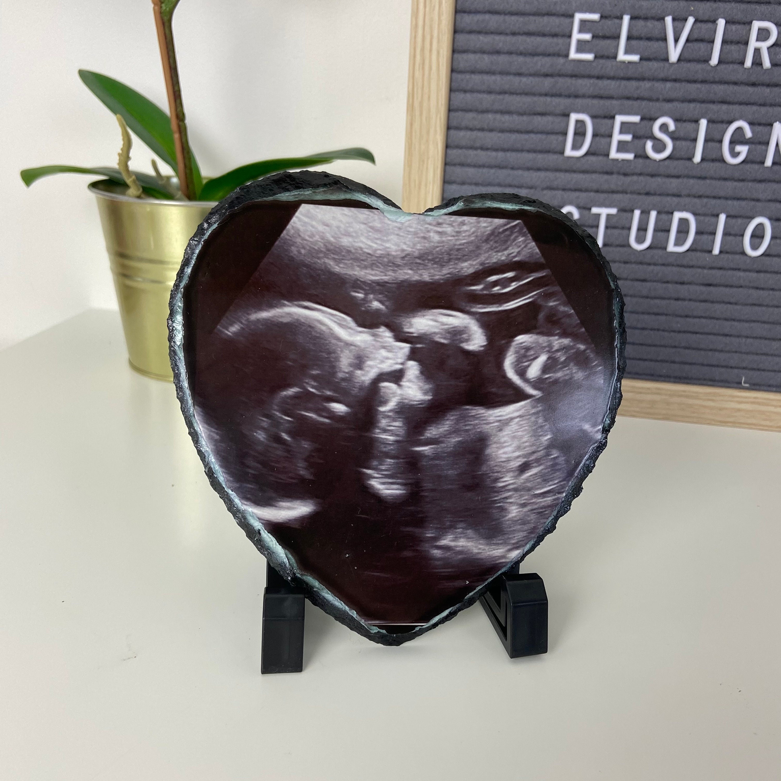 Baby Ultrasound Ultrasound Frame Miscarriage Keepsake New Etsy