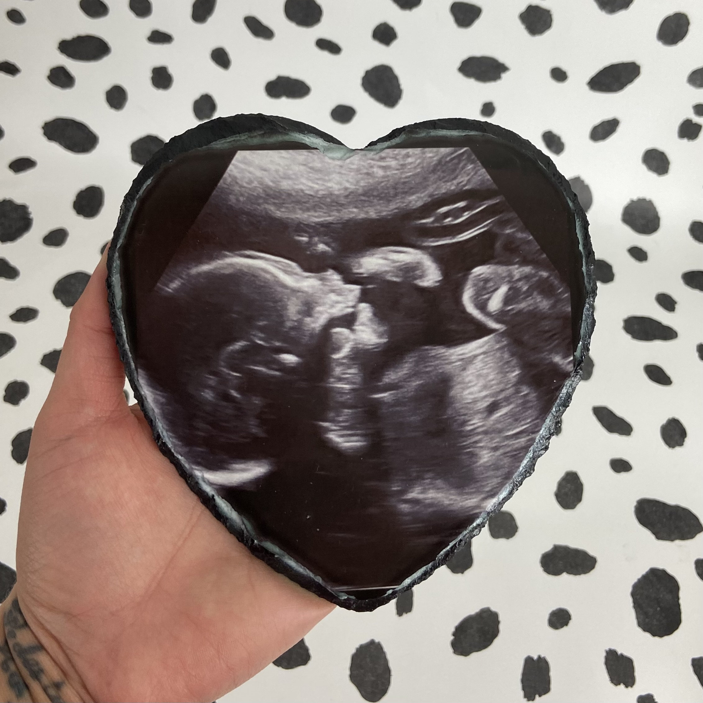 Baby Ultrasound Ultrasound Frame Miscarriage Keepsake New Etsy