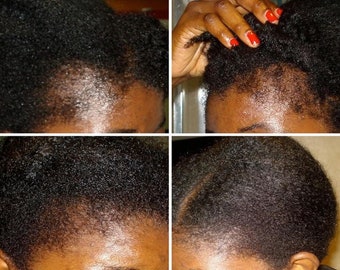 Magical Hair Growth Oil,Regrowth Serum,Hair Loss, Men hairloss, women hair loss, kids hairless Infused Jamaican Black Castor Oil