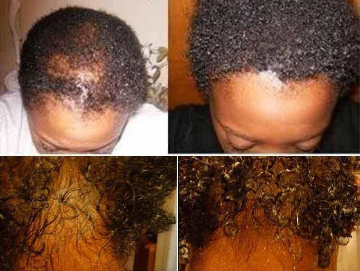 HAIR GROWTH PRODUCTS FOR BLACK WOMEN Etsy