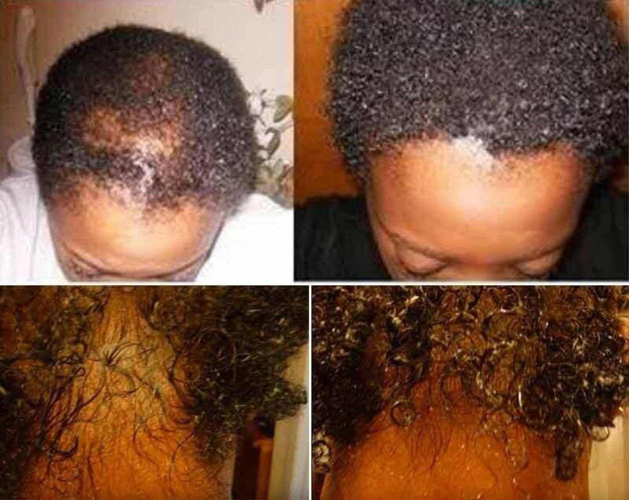 Magical Hair Growth Oilregrowth Serumhair Loss Men - Etsy Magical Hair Growth Oilregrowth Serumhair Loss Men - Etsy