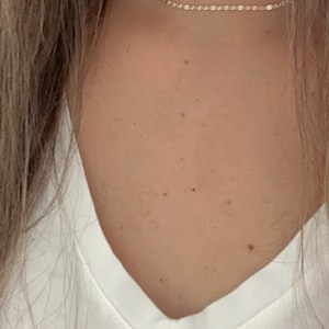 May include: A close-up of a person's neck wearing a delicate gold chain necklace.