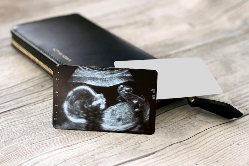 Puede incluir: Una cartera negra con una cremallera dorada y una tarjeta blanca con una imagen de ultrasonido en blanco y negro de un beb&eacute;.