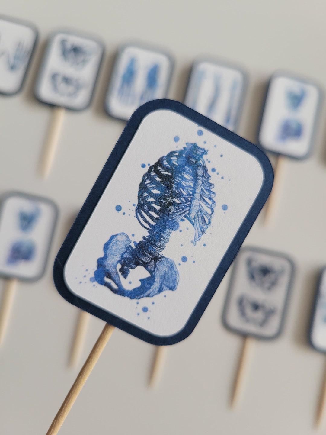 Xray Radiology Technician Skeleton Medical Imaging Bones Bone