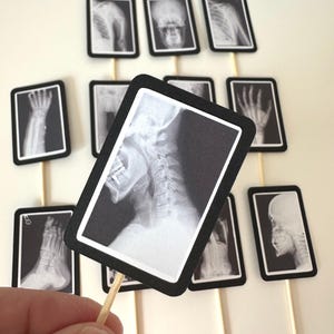 Xray Radiology Technician Skeleton Medical Imaging Bones Bone Densitometry Diagnosis Party Graduation Hospital Clinic Cupcake Toppers #1