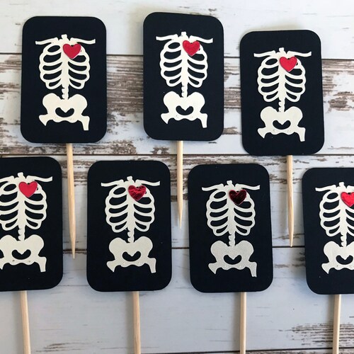 Xray Radiology Technician Skeleton Chest Heart Medical Imaging Etsy