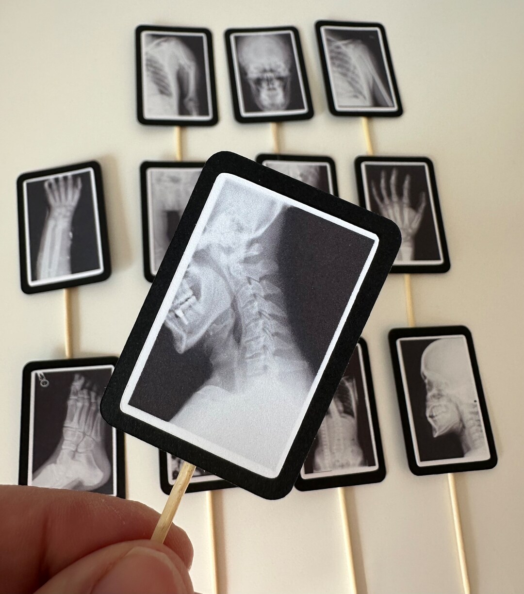 Xray Radiology Technician Skeleton Medical Imaging Bones Bone