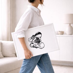 Hips Anatomy Print, Vintage Medical Wall Art (Digital Download) image 2
