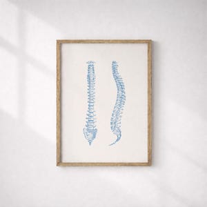 Könnte beinhalten: Ein gerahmter Druck mit zwei blauen anatomischen Darstellungen der menschlichen Wirbelsäule. Eine Wirbelsäule ist gerade, die andere ist gekrümmt. Das Kunstwerk ist in einem hellbraunen Holzrahmen gerahmt.