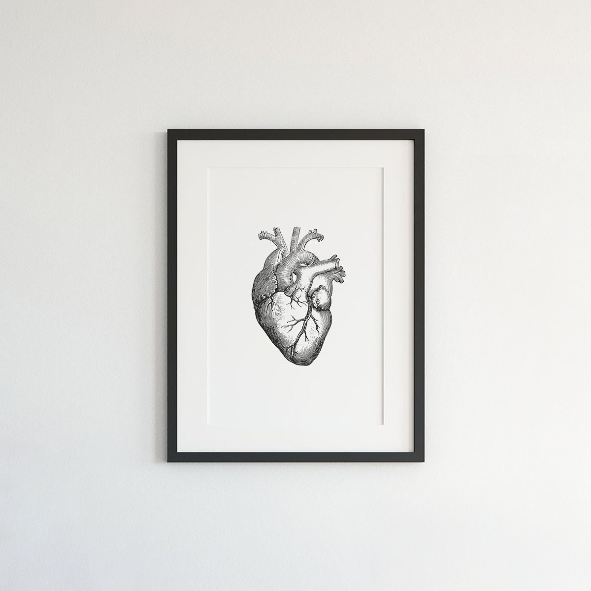 Anatomical Heart Print, Vintage Medical Art, Heart Wall Art, Anatomy ...
