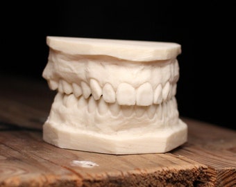Human Dental Cast - various finishes - oddity - human curiosity