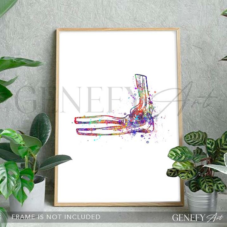 May include: A colorful watercolor illustration of the human elbow joint. The bones are outlined in black and filled with vibrant colors, creating a unique and artistic anatomical representation.