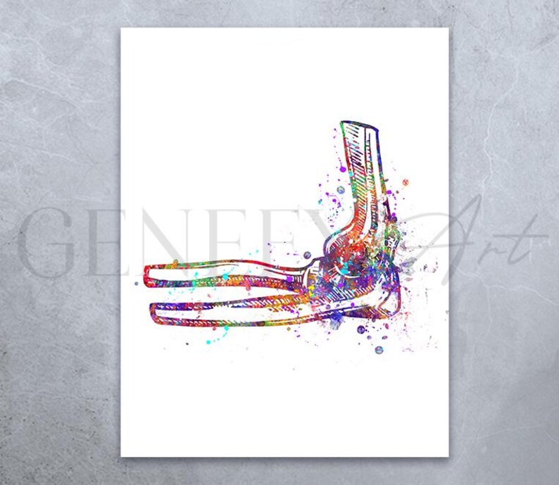 May include: A colorful watercolor illustration of a human elbow joint. The bones are depicted in detail, with a splash of color around the joint.
