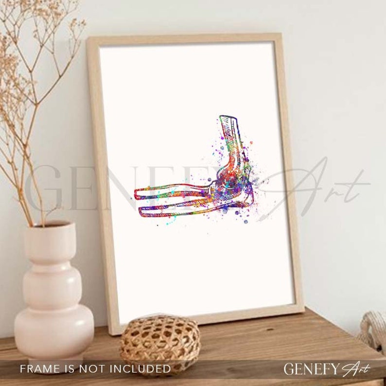 May include: A colorful watercolor illustration of the human elbow joint. The bones are depicted in a rainbow of colors, with splashes of paint around the image.