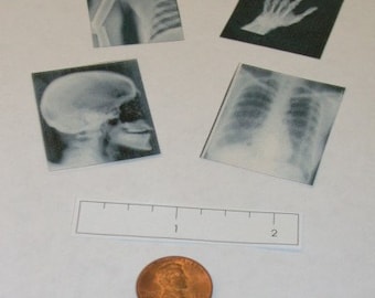 Miniature Doctor's Office X-Rays