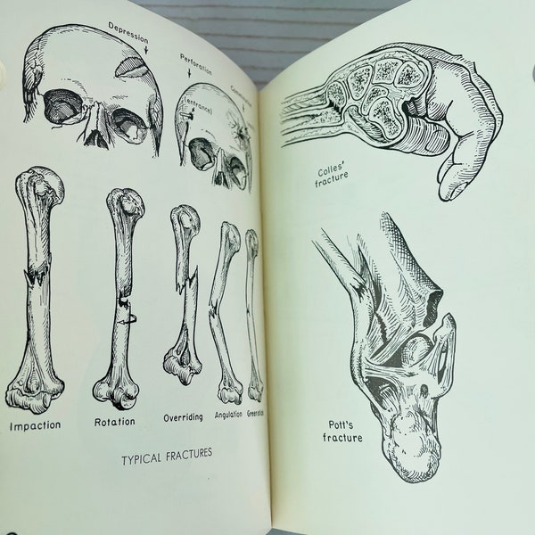 1960 Blakiston's Illustrated Pocket Medical Dictionary" Second edition--Medical Dictionary