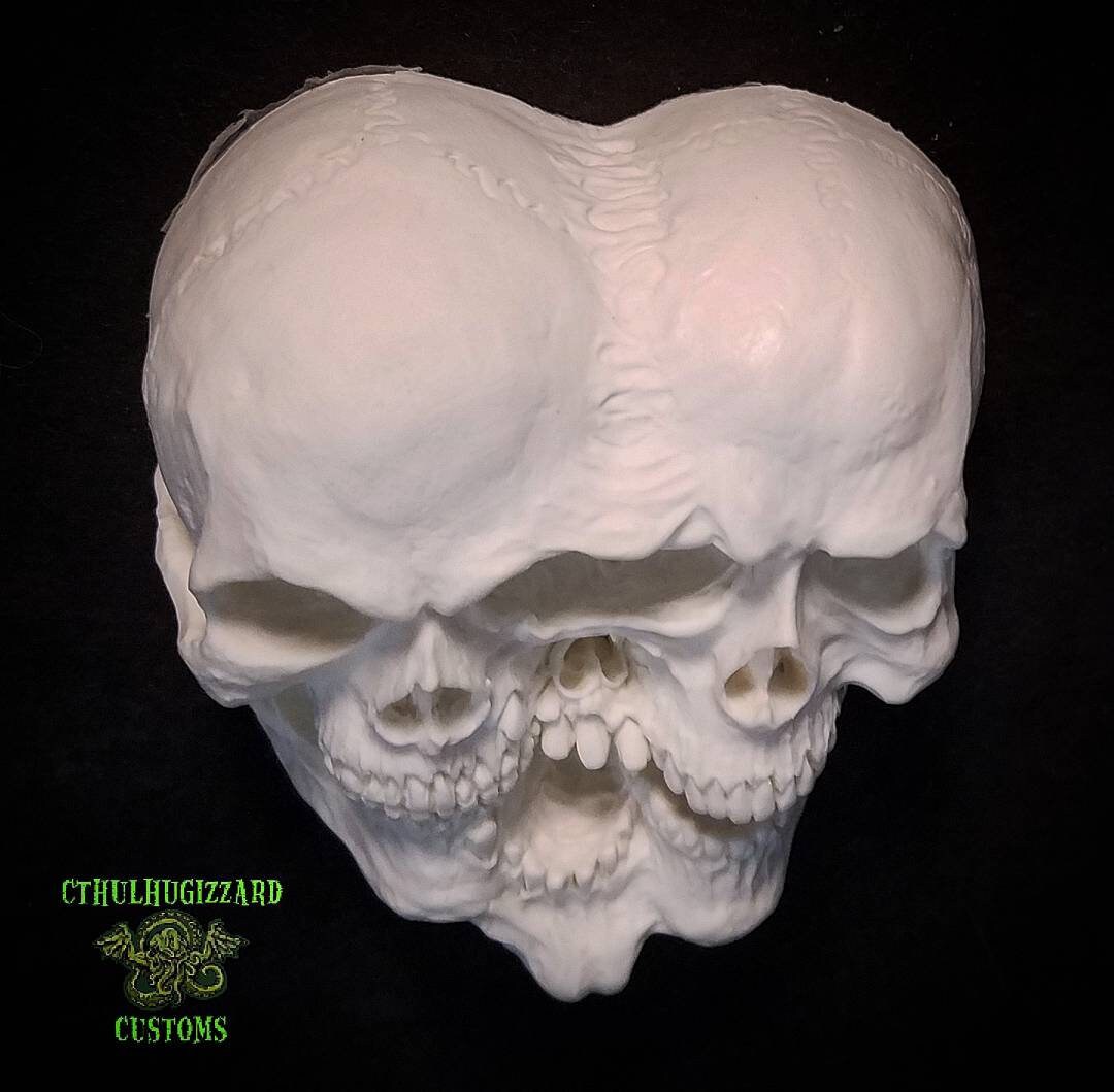 Siblings Conjoined Triplet Skulls Relief Version 2 . A 1/4 Scale